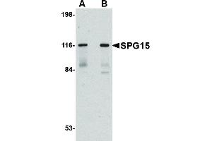 Image no. 1 for anti-Zinc Finger, FYVE Domain Containing 26 (ZFYVE26) (C-Term) antibody (ABIN6656423)