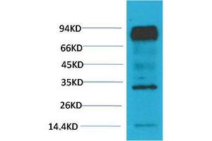 Image no. 1 for anti-Aryl Hydrocarbon Receptor Nuclear Translocator (ARNT) antibody (ABIN3181699)