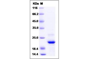 Image no. 1 for ADP-Ribosylation Factor-Like 2 Binding Protein (ARL2BP) (AA 1-163), (Mature) protein (His tag) (ABIN2006158)