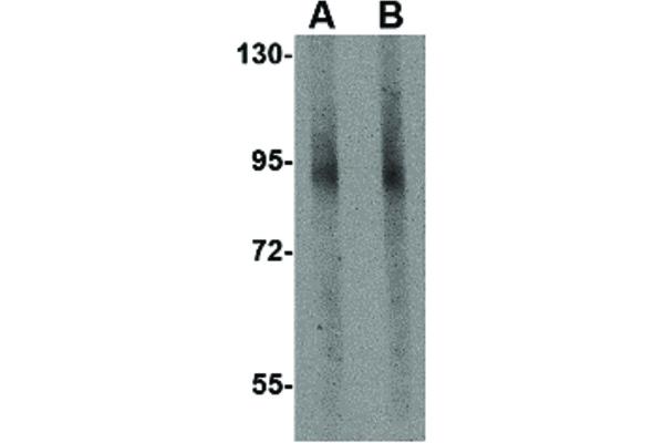 GLE1 Antikörper  (C-Term)