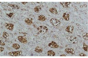 Immunohistochemistry of paraffin-embedded Human kidney tissue using NFKBIB Monoclonal Antibody at dilution of 1:200.