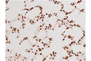 Image no. 13 for anti-REL proto-oncogene (c-Rel) (pSer503) antibody (ABIN6255382)