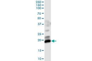 Immunoprecipitation of GUCA1C transfected lysate using anti-GUCA1C MaxPab rabbit polyclonal antibody and Protein A Magnetic Bead , and immunoblotted with GUCA1C purified MaxPab mouse polyclonal antibody (B01P) .