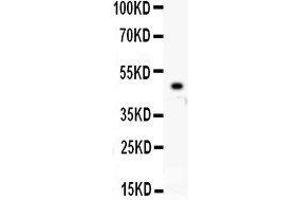 Image no. 4 for anti-Kinesin Family Member 2C (KIF2C) (AA 531-725) antibody (ABIN3043278)