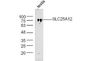 Image no. 1 for anti-Solute Carrier Family 25 (Mitochondrial Carrier, Aralar), Member 12 (Slc25a12) (AA 101-200) antibody (ABIN1385908)
