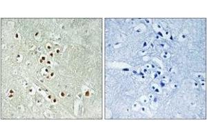 anti-Growth Arrest and DNA-Damage-Inducible, gamma Interacting Protein 1 (GADD45GIP1) (AA 91-140) antibody