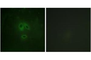 Immunofluorescence analysis of HeLa cells, using n-NOS (Phospho-Ser852) Antibody.