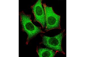 Image no. 3 for anti-PAP Associated Domain Containing 4 (PAPD4) (AA 58-87), (N-Term) antibody (ABIN651284)