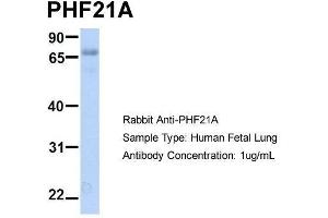 Image no. 3 for anti-PHD Finger Protein 21A (PHF21A) (N-Term) antibody (ABIN2781018)