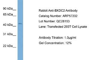Image no. 2 for anti-BRX1, Biogenesis of Ribosomes, Homolog (BRIX1) (Middle Region) antibody (ABIN2787115)