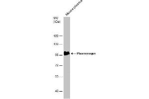 Image no. 10 for anti-Plasminogen (PLG) (Center) antibody (ABIN2855505)