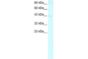 Image no. 2 for anti-Forkhead Box P1 (FOXP1) (N-Term) antibody (ABIN2779725)