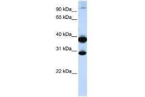 Image no. 1 for anti-Zinc Finger Protein 138 (ZNF138) (C-Term) antibody (ABIN928178)