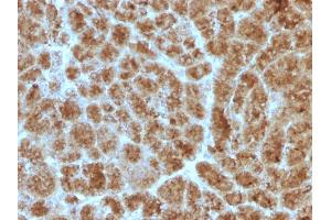 Image no. 2 for anti-Elastase 3B, Pancreatic (ELA3B) (AA 82-238) antibody (ABIN6939418)
