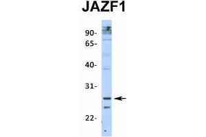 Image no. 7 for anti-JAZF Zinc Finger 1 (JAZF1) (N-Term) antibody (ABIN2775141)