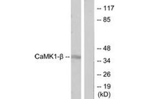 Image no. 1 for anti-Pregnancy Up-Regulated Non-Ubiquitously Expressed CaM Kinase (PNCK) (AA 161-210) antibody (ABIN1533961)