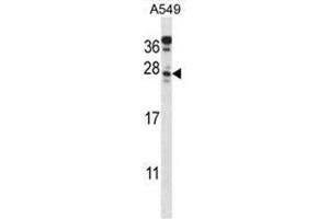 anti-Chromosome 4 Open Reading Frame 49 (C4orf49) (AA 175-204), (C-Term) antibody