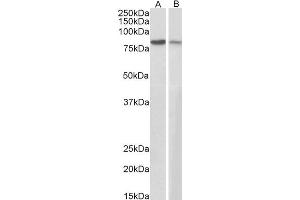 Image no. 3 for anti-Junction Plakoglobin (JUP) (C-Term) antibody (ABIN184775)