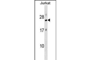 RPL18 Antibody (N-term) (ABIN1538828 and ABIN2849097) western blot analysis in Jurkat cell line lysates (35 μg/lane).