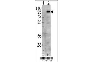 Image no. 2 for anti-Phosphatidylinositol-4-Phosphate 5-Kinase, Type I, gamma (PIP5K1C) (AA 637-668), (C-Term) antibody (ABIN392596)