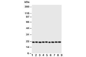 Image no. 2 for anti-Cytoglobin (CYGB) (N-Term) antibody (ABIN3030693)