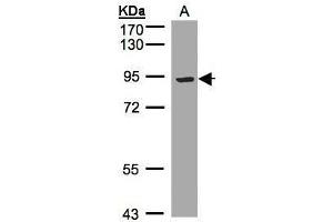 Image no. 1 for anti-Low Density Lipoprotein Receptor-Related Protein 12 (LRP12) (C-Term) antibody (ABIN2856618)