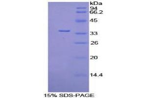 Image no. 1 for Pyruvate Dehydrogenase Kinase, Isozyme 4 (PDK4) (AA 117-387) protein (His tag) (ABIN1878459)