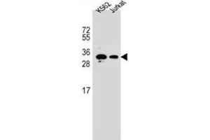 Image no. 1 for anti-Homeobox A6 (HOXA6) (AA 112-141), (Middle Region) antibody (ABIN952775)