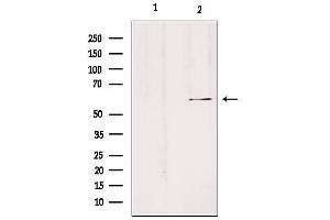 Image no. 3 for anti-Solute Carrier Family 24 Member 3 (SLC24A3) antibody (ABIN6259279)