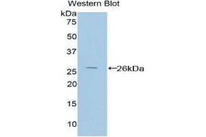 Image no. 1 for anti-Protein Interacting With Protein Kinase C, alpha 1 (PICK1) (AA 24-229) antibody (ABIN1860209)