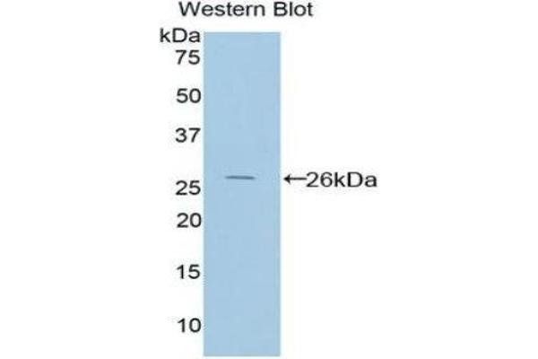 anti-Protein Interacting With Protein Kinase C, alpha 1 (PICK1) (AA 24-229) antibody