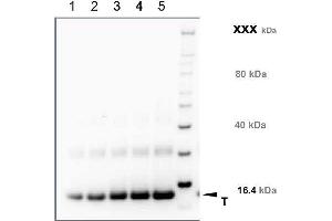 Image no. 2 for anti-Transmembrane Protein 37 (TMEM37) (N-Term) antibody (ABIN1720796)