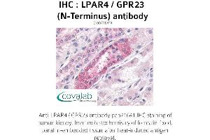 Image no. 1 for anti-Lysophosphatidic Acid Receptor 4 (LPAR4) (Extracellular Domain), (N-Term) antibody (ABIN1736526)