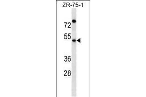 anti-Essential Meiotic Endonuclease 1 Homolog 2 (EME2) (AA 249-278), (C-Term) antibody