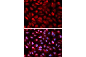 Image no. 2 for anti-Poly(rC) Binding Protein 2 (PCBP2) antibody (ABIN3023340)