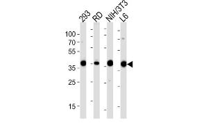 Image no. 2 for anti-Aldolase (ALD) antibody (ABIN3001589)