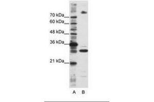 Image no. 2 for anti-serine/arginine-Rich Splicing Factor 10 (SRSF10) (C-Term) antibody (ABIN6736232)