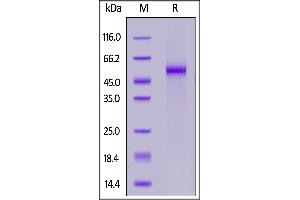 Image no. 2 for delta Like Protein 3 (DLL3) (AA 27-492) (Active) protein (His tag,FITC) (ABIN7013753)