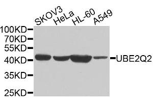 Image no. 1 for anti-Ubiquitin-Conjugating Enzyme E2Q Family Member 2 (UBE2Q2) antibody (ABIN6149819)