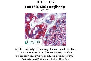 Image no. 1 for anti-Trk-Fused Gene (TFG) (AA 350-400) antibody (ABIN1740008)