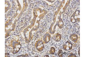 Image no. 3 for anti-rho-Associated, Coiled-Coil Containing Protein Kinase 2 (ROCK2) (AA 1279-1388) antibody (ABIN522961)