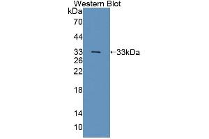 anti-Testis-Specific Kinase 1 (TESK1) (AA 52-309) antibody