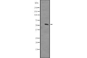 Image no. 1 for anti-Homeobox and Leucine Zipper Encoding (HOMEZ) (Internal Region) antibody (ABIN6258845)
