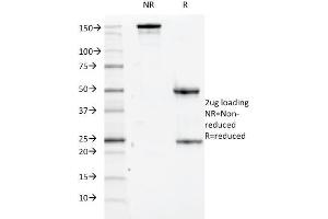 Image no. 1 for anti-CD84 (CD84) antibody (ABIN6940976)