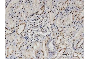 Immunoperoxidase of monoclonal antibody to SP140 on formalin-fixed paraffin-embedded human kidney.