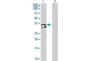 Image no. 3 for anti-Uracil-DNA Glycosylase (UNG) (AA 1-304) antibody (ABIN521262)