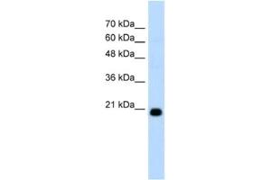 Image no. 1 for anti-F-Box Protein 25 (FBXO25) antibody (ABIN2462666)