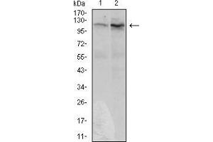 Image no. 3 for anti-DIS3-Like Exonuclease 2 (DIS3L2) (AA 27-250) antibody (ABIN1724900)