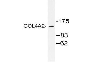 Image no. 2 for anti-Collagen, Type IV, alpha 2 (COL4A2) (Chain alpha 2) antibody (ABIN498375)