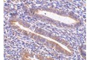 Image no. 1 for anti-Hepatitis A Virus Cellular Receptor 1 (HAVCR1) (N-Term) antibody (ABIN500911)